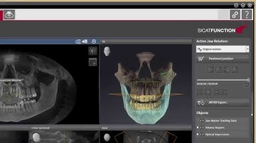 SICAT Function - User Interface Overview