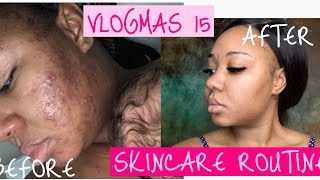 VLOGMAS 15: PCOS SKINCARE ROUTINE + WINNER OF GIVEAWAY