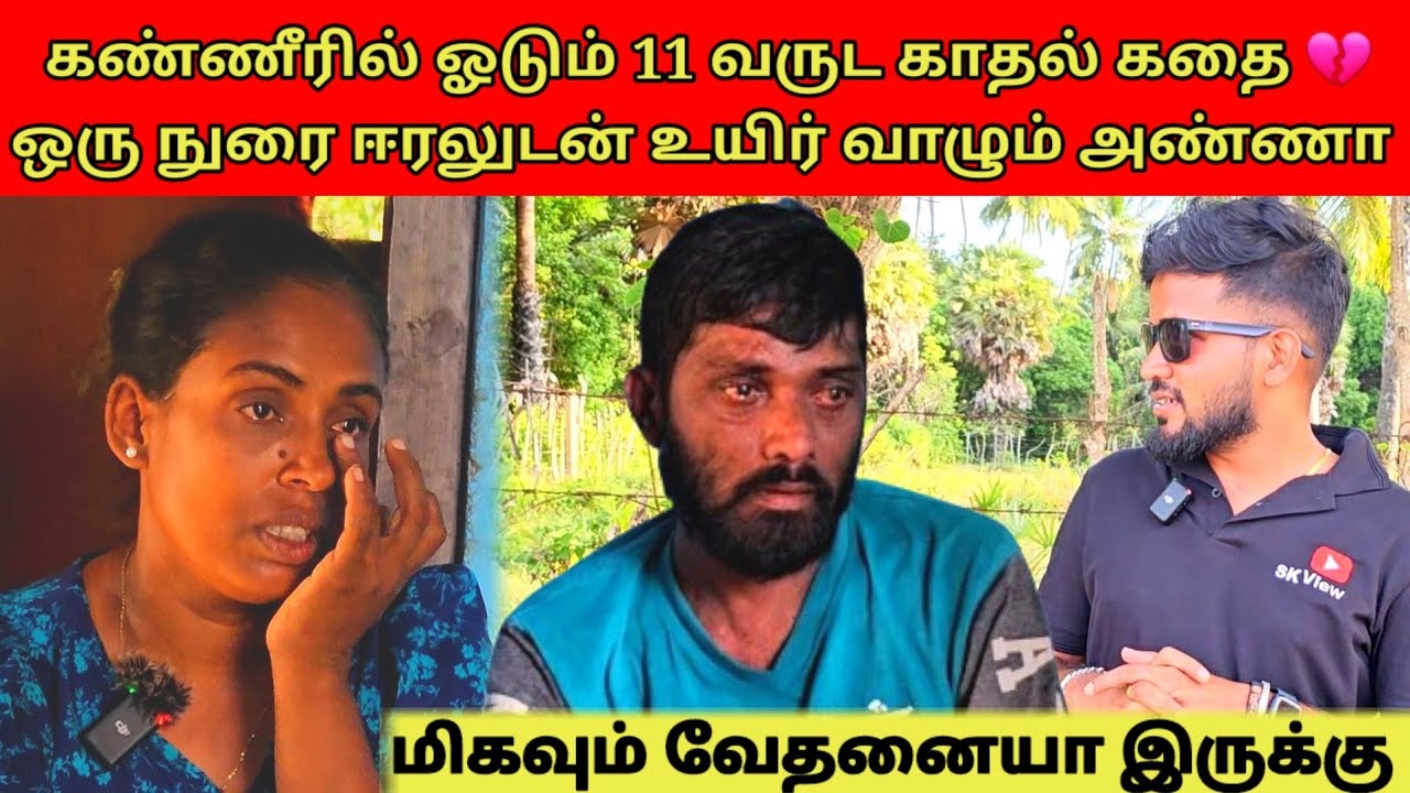 கடவுளே என்ன கொடுமை? | மில்லியனில் ஒருத்தருக்கே இப்படி வரும் | Tamil | SK VLOG
