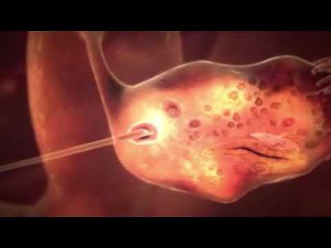 ივ ვიტრო - ეტაპები