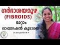 ഗർഭാശയമുഴ  (Fibroids)  മാറ്റാം   ഓപ്പറേഷൻ കൂടാതെ | ഗർഭാശയമുഴ ക്യാൻസറാണോ ? | Health 4 Happiness