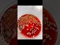 This is the rhythm of 🧫🦠🔬 #petriplate #bacteria #microbiology #microbes #viralvideo #microbialworld
