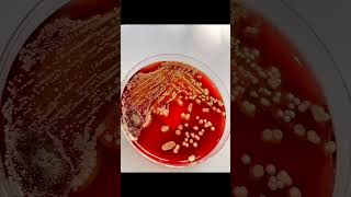 This is the rhythm of 🧫🦠🔬 #petriplate #bacteria #microbiology #microbes #viralvideo #microbialworld