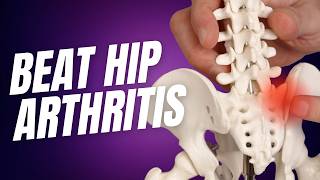 Why People Fail to Heal Hip Osteoarthritis