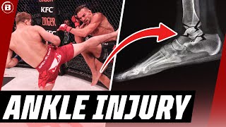 Ankle INJURY 🔥 Brent Primus vs Michael Chandler | Bellator MMA