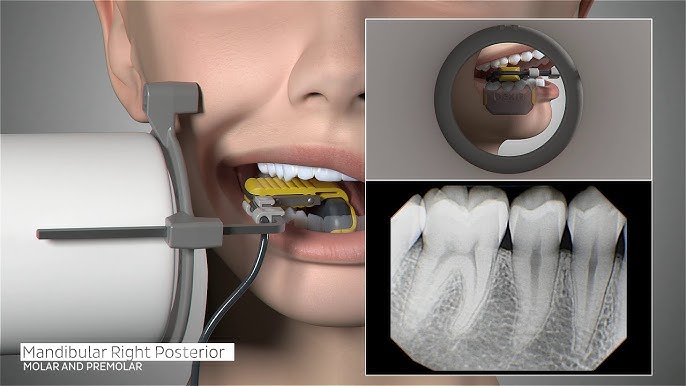 DermaDam™ and DermaDam™ Synthetic-Dental Dams