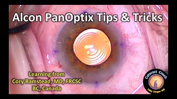 Alcon PanOptix Trifocal IOL Tips & Tricks for Cataract Surgery