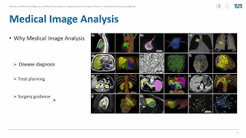 Swin-Unet: Unet-like Pure Transformer for Medical Image Segmentation