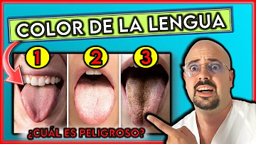¿Cuál es el color saludable de la lengua?