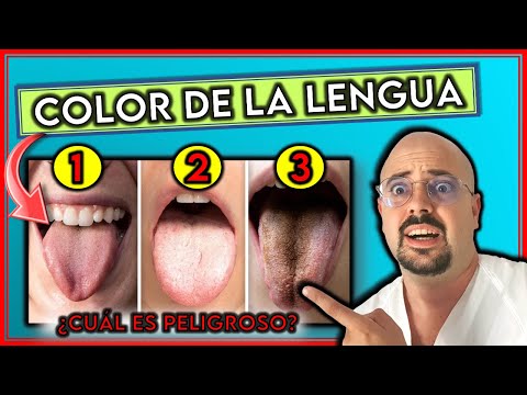 Vídeo: 3 maneres de tenir una llengua sana