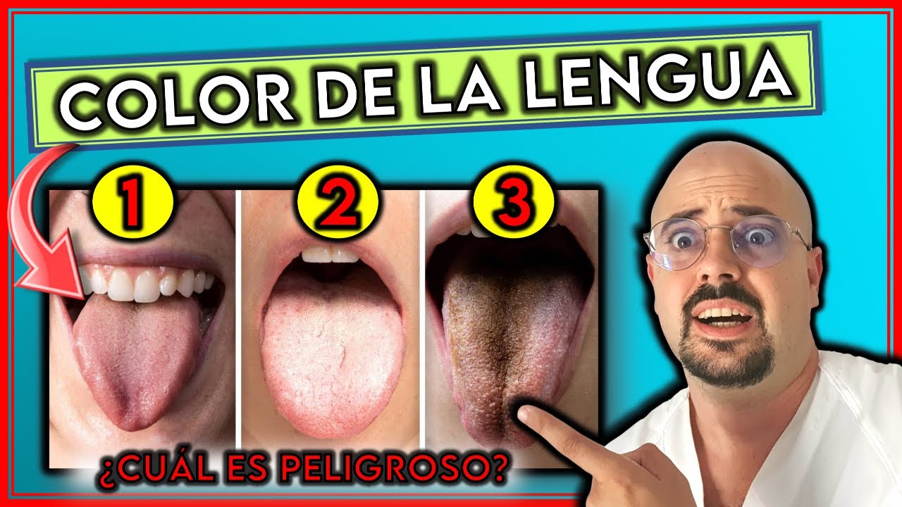 Que significa la q en lgtbiq