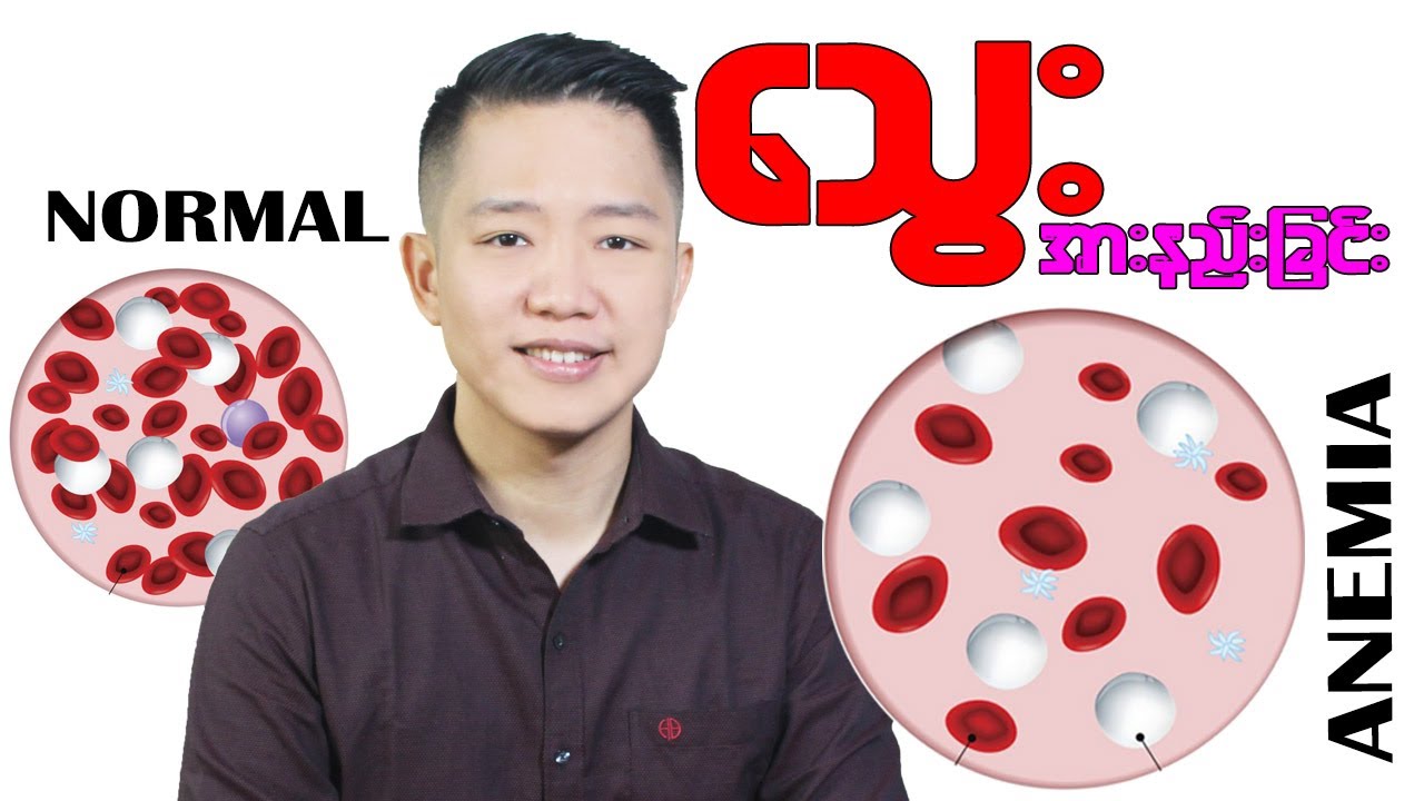 သွေးအားနည်းရောဂါက အသက်သေစေတတ်တယ်ဆိုတာသိပြီးပြီလား?