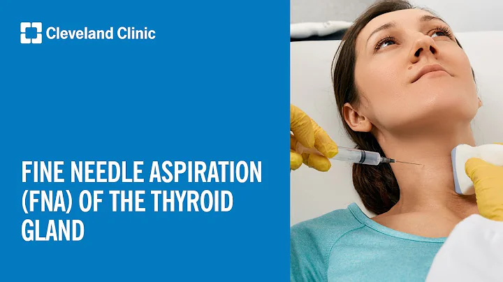 Fine Needle Aspiration (FNA) of the Thyroid Gland