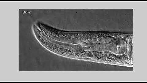 High speed video of C. elegans adult feeding on OP50 bacteria.