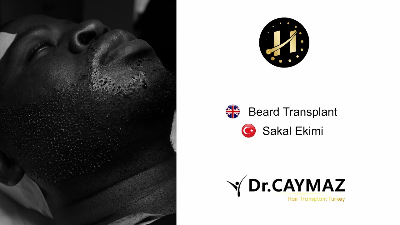Beard Transplantation in Istanbul
