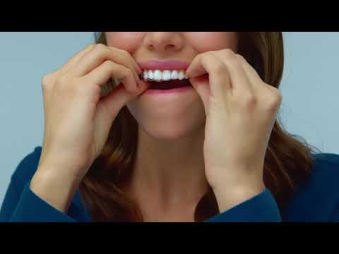 REVEAL How To video 2:  Je Reveal Aligners verwijderen