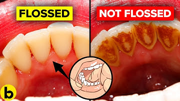 8 Things That Happen When You Don’t Floss Your Teeth