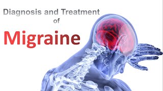 Migraine Diagnosis and Treatment I All you need to know