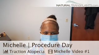 Life-Changing Hair Transplant Surgery for Traction Alopecia | Dr. Matt Huebner (Michelle)