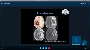 Cosa sono i tumori ematologici?