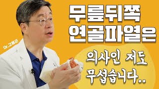 반월상연골파열증상, 무릎 뒤쪽 통증을 유발하는 후각부파열은 한국인의 발병률이 높다?