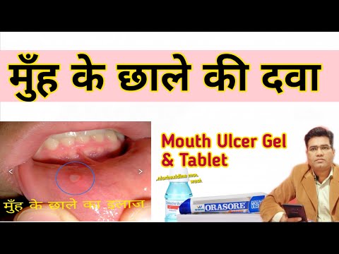 Video: Hvilken tablett mot munnsår?
