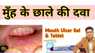 What are The Best Medicine For Mouth ulcer, ( Gel Mouthwash & Tablets  )