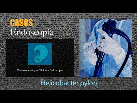 Helicobacter Pylori Sintomas Y Tratamiento Youtube