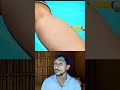 anti snake venom #rahulrao