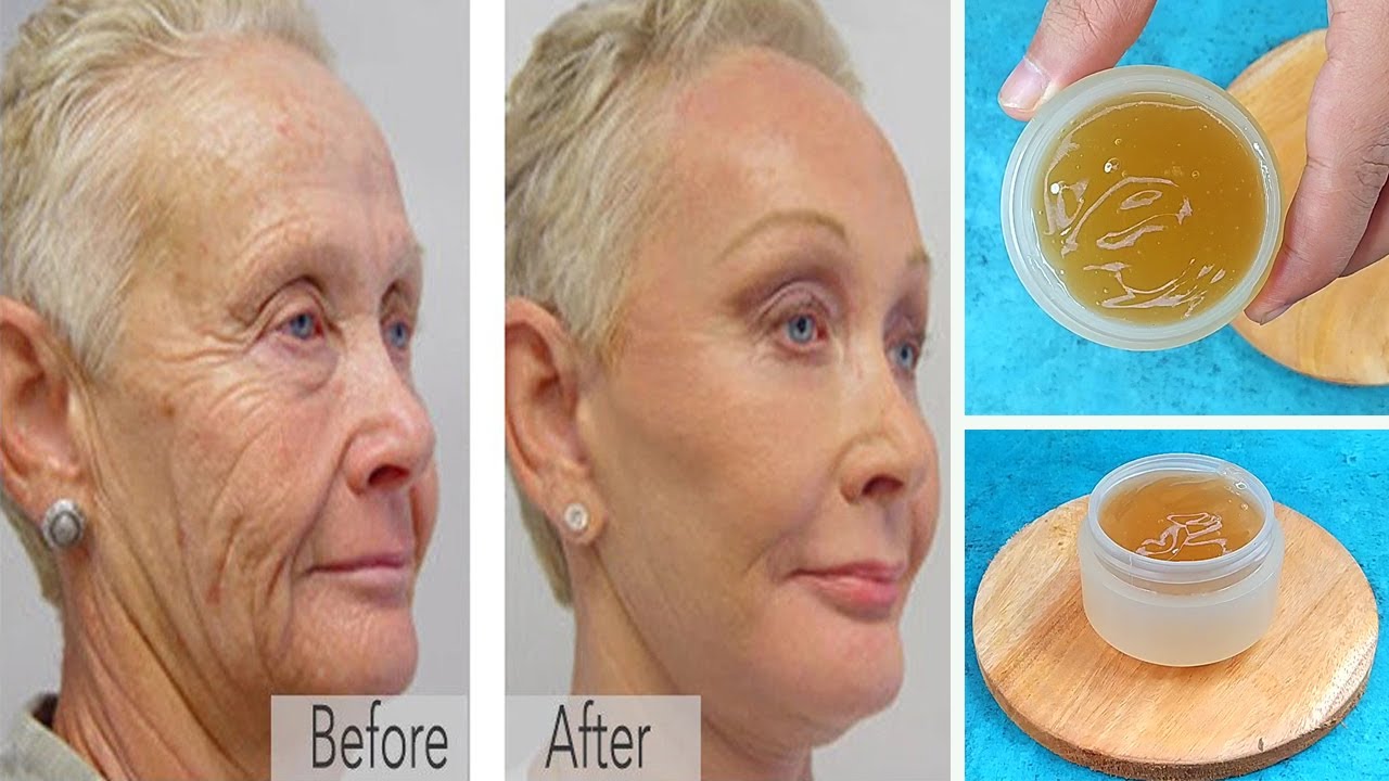 🔥 Unbelievable! Antiaging magic gel 🌱 stimulates collagen and fills in