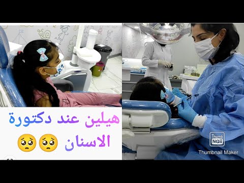 رحنا ع دكتور الاسنان مشان تصليح اسنان هيلين