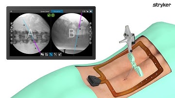Stryker: SpineMap Go Animation
