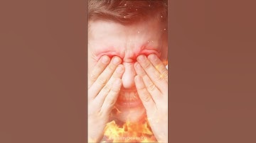 What Happens If Super Glue Gets in Your Eye? 😱👁️🧴 #MythBusting#ytshorts