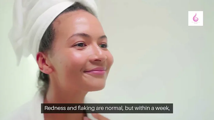 Chemical Peels in Southlake, TX – Say Goodbye to Dull Skin! ✨