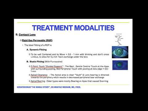 Contact Lens in keratoconus by Dr.Moataz Wessam