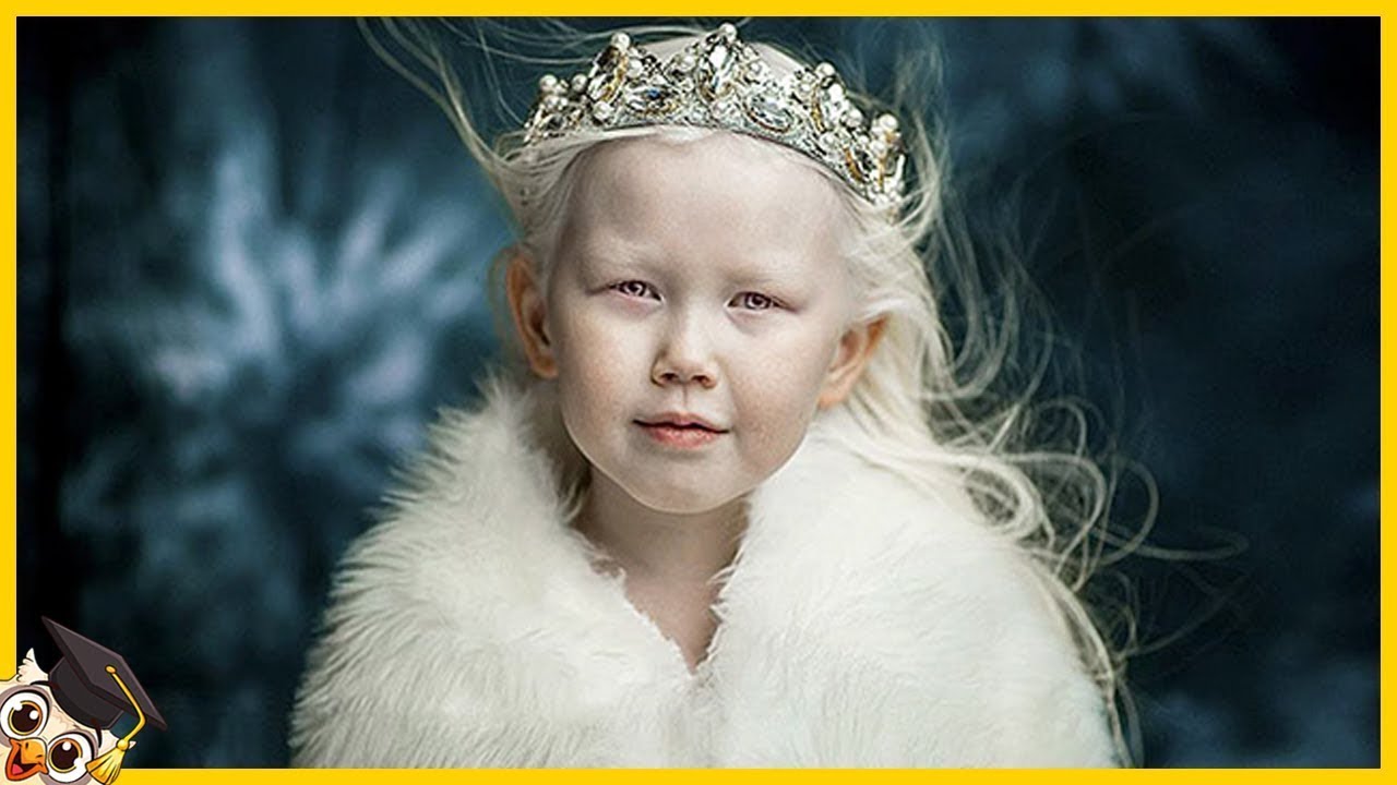 20 Personnes Albinos Qui Ne Naissent Qu'une Fois Tous Les Mille Ans