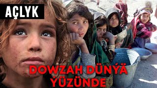 Açlyk? | Bu manysyz