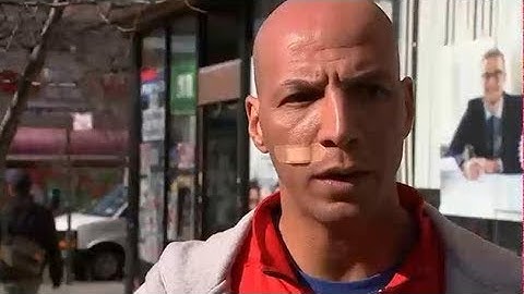 Man slashed in face in Times Square speaks out about attack