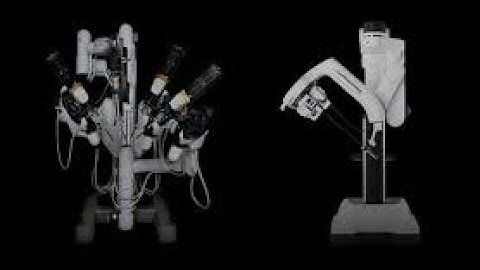 Robotic side to side choledochoduodenostomy for benign biliary stricture