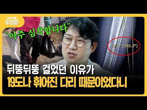 뒤뚱뒤뚱 걸었던 이유가 19도나 휘어진 다리 때문! #다리통증 #휜다리 [마냥 이쁜 우리맘]