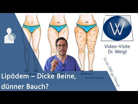 Video: Fett Am Bein - Ursachen, Symptome Und Behandlung