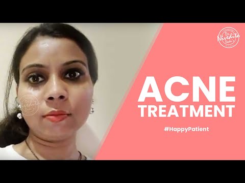 Patient Testimonial | Happy Patients | Acne Treatment | Acne Scars Treatment