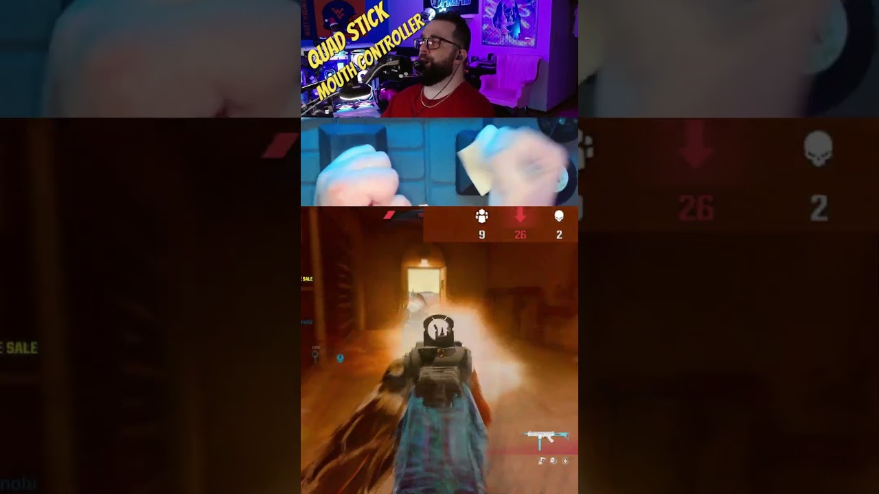 TR2 Conversion Kit Meta 