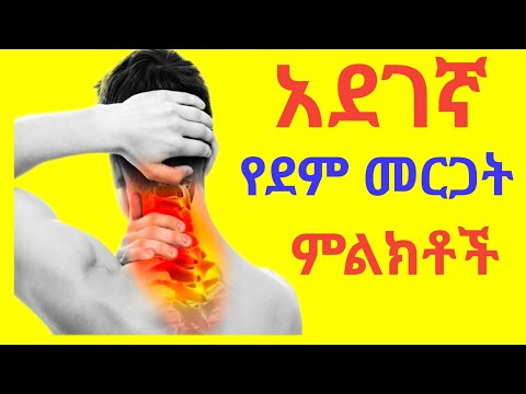 ቪዲዮ: በእግሮች ላይ የተዘረጋ ምልክቶችን ለመሸፈን 3 መንገዶች