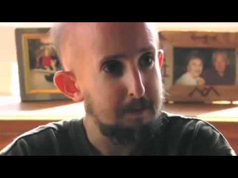 Ver video de Retrovertigo español