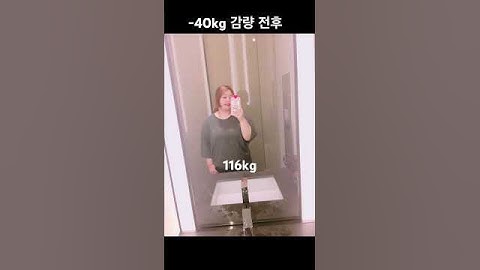 초고도비만 -40kg 감량 전후 #다이어트 #다이어트전후