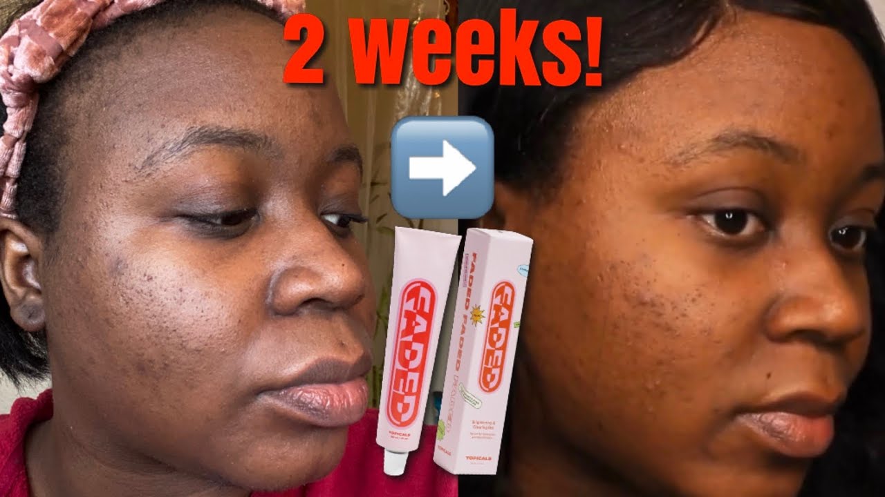 faded serum topicals