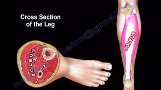 Anatomy Of The Soleus Muscle - Everything You Need To Know - Dr. Nabil Ebraheim