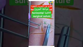 خياطة الجروح الافقية horizontal surgical suture suturing