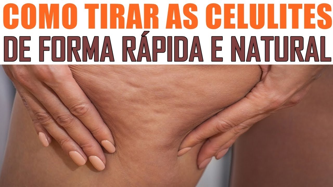 Como Tirar Celulite de Forma Rápida e Natural! (INCRÍVEL) 😍😱 - YouTube